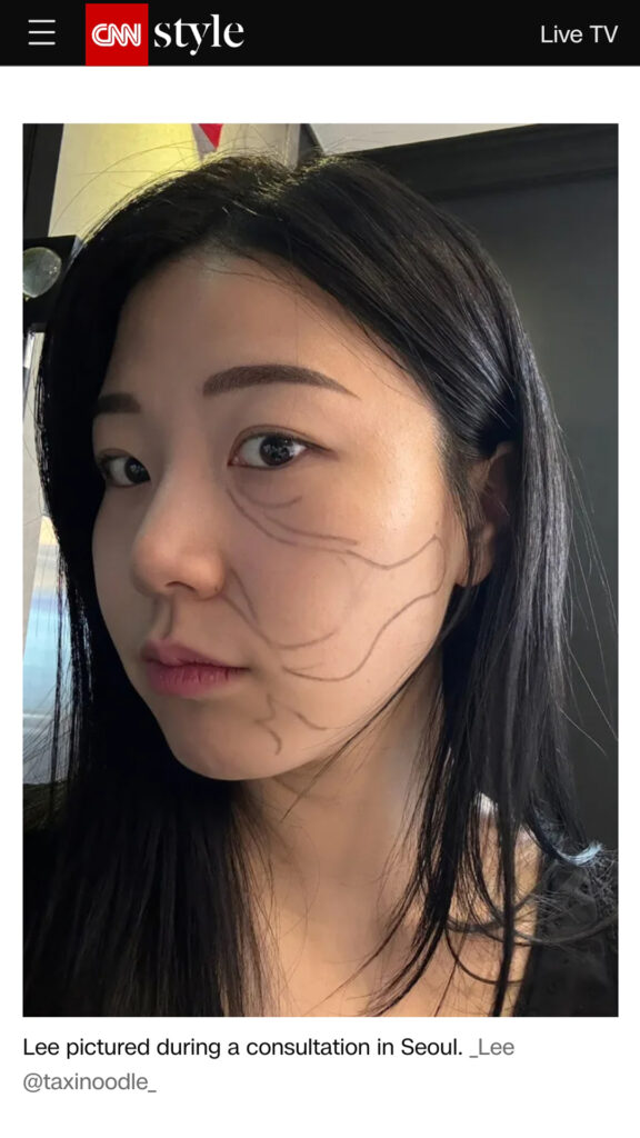 Ultherapy